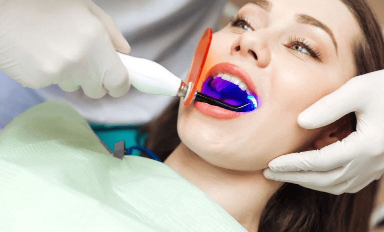 Tẩy trắng răng ố vàng: Nên hay không?