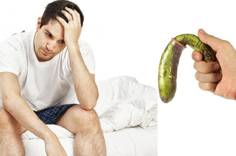 Xuất tinh sớm: Nguyên nhân và cách cải thiện hiệu quả